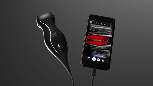 iPhoneを超音波検査機にするデバイス。実際に「ガン」も発見!
